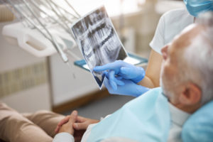 dental specialist showing an x ray of teeth to a p 2021 09 03 14 19 06 utc 1