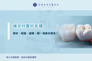 補牙材質好多種：銀粉、樹脂、齒雕，哪一個壽命最長？
