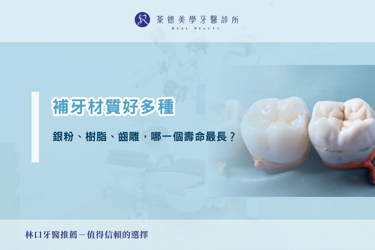 補牙材質好多種：銀粉、樹脂、齒雕，哪一個壽命最長？