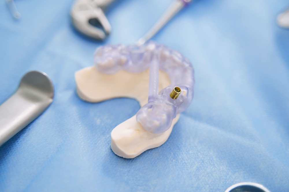 teeth model with dental implant in stomatology cli 2022 03 31 17 41 58 utc 1