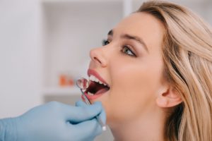 dentist examining teeth of young woman with mouth 2022 12 16 16 18 17 utc 1