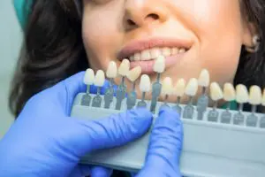 新首頁 5 tooth whitening chart 2021 08 31 13 51 49 utc 1