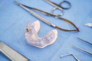 teeth model with metal implant and dental tools 2022 03 31 17 41 56 utc 4 1