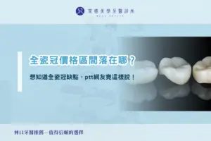 全瓷冠 11 全瓷冠價格區間落在哪?想知道全瓷冠缺點,ptt網友竟這樣說