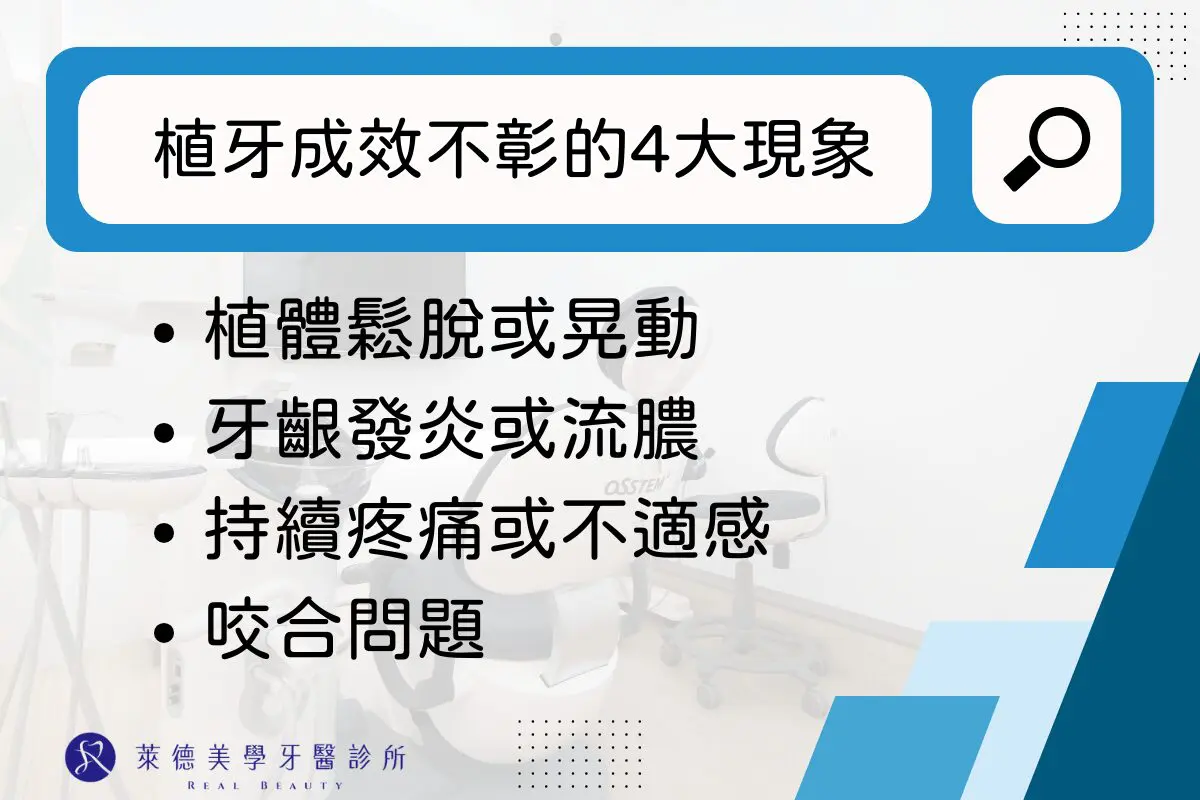 植牙失敗如何補救?植牙失敗症狀又有哪些? 1 RD Banner 37