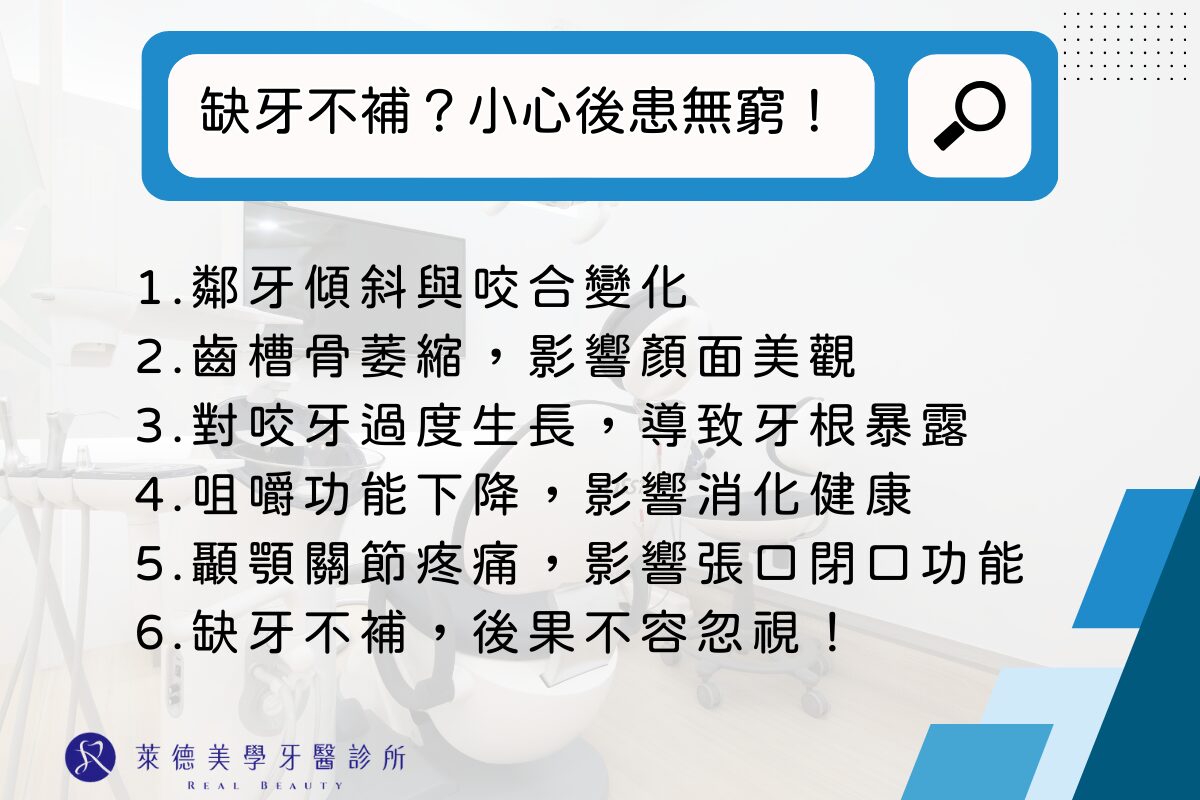 一定要植牙嗎?缺牙不植牙會怎樣? 1 RD Banner 8