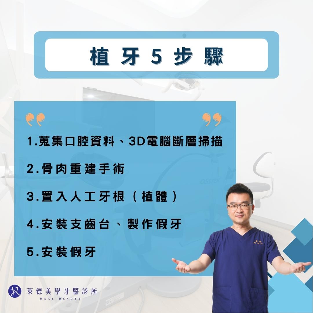 植牙手術時間要多久?植牙前我需要準備什麼嗎? 1 植牙5步驟