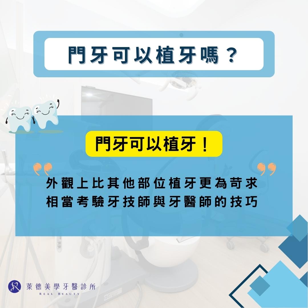 門牙可以植牙嗎?門牙植牙過程大公開 1 門牙可以植牙嗎