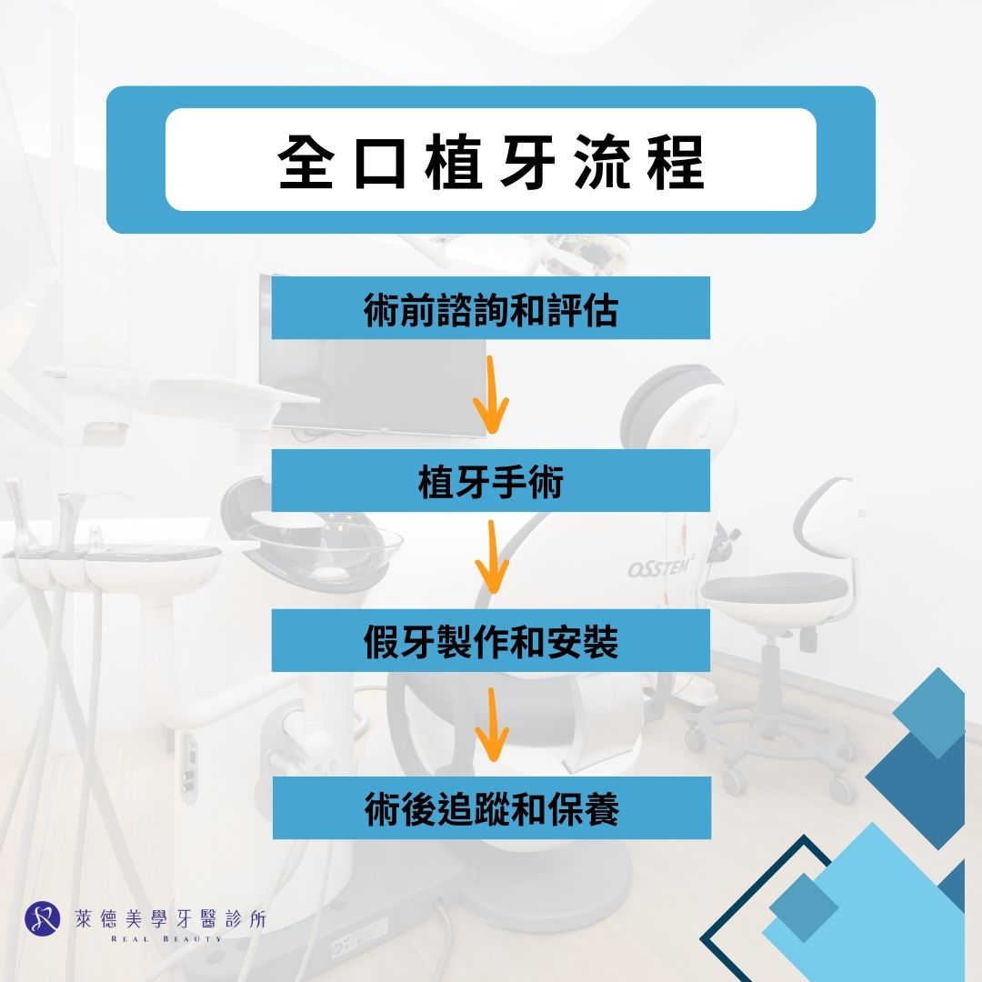 全口植牙費用、流程、缺點風險完整解析! 2 全口植牙流程
