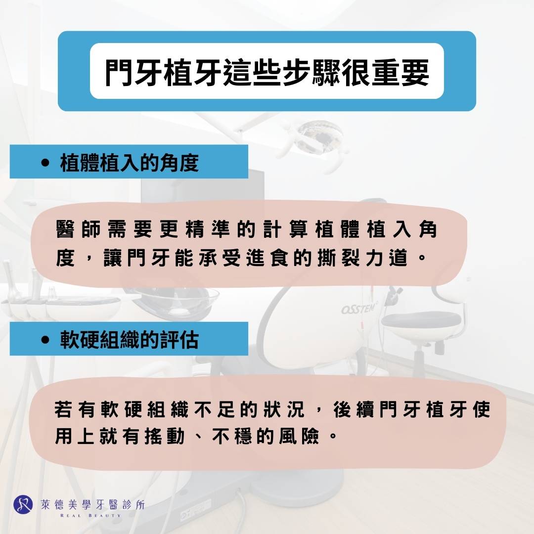 門牙可以植牙嗎?門牙植牙過程大公開 3 門牙植牙這些步驟很重要