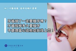 牙齒掉了一定要植牙嗎？ 牙齒拔掉多久要植牙 不處理當心這些症狀找上您！
