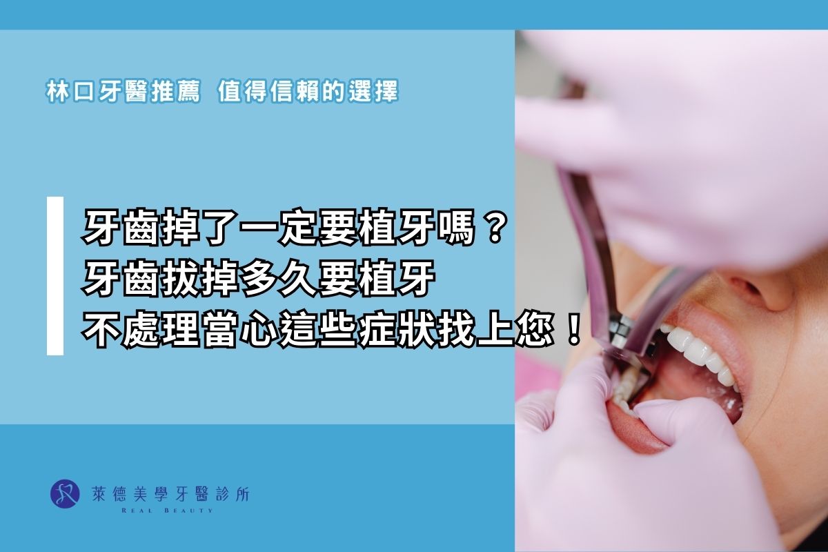 牙齒掉了一定要植牙嗎？ 牙齒拔掉多久要植牙 不處理當心這些症狀找上您！