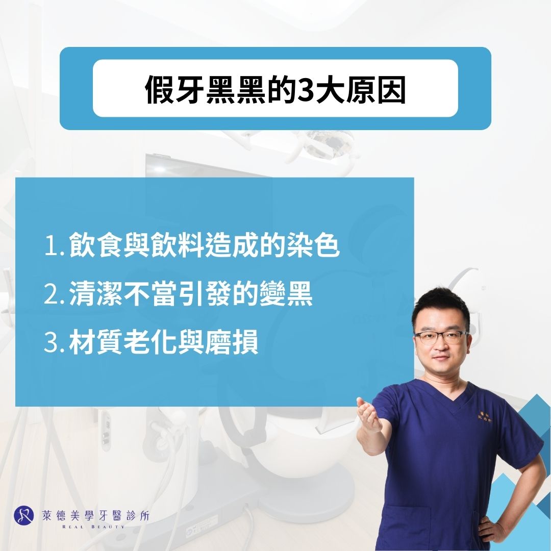 為什麼假牙黑黑的?假牙黑黑的3大原因與處理方法一次搞懂 2 假牙黑黑的3大原因