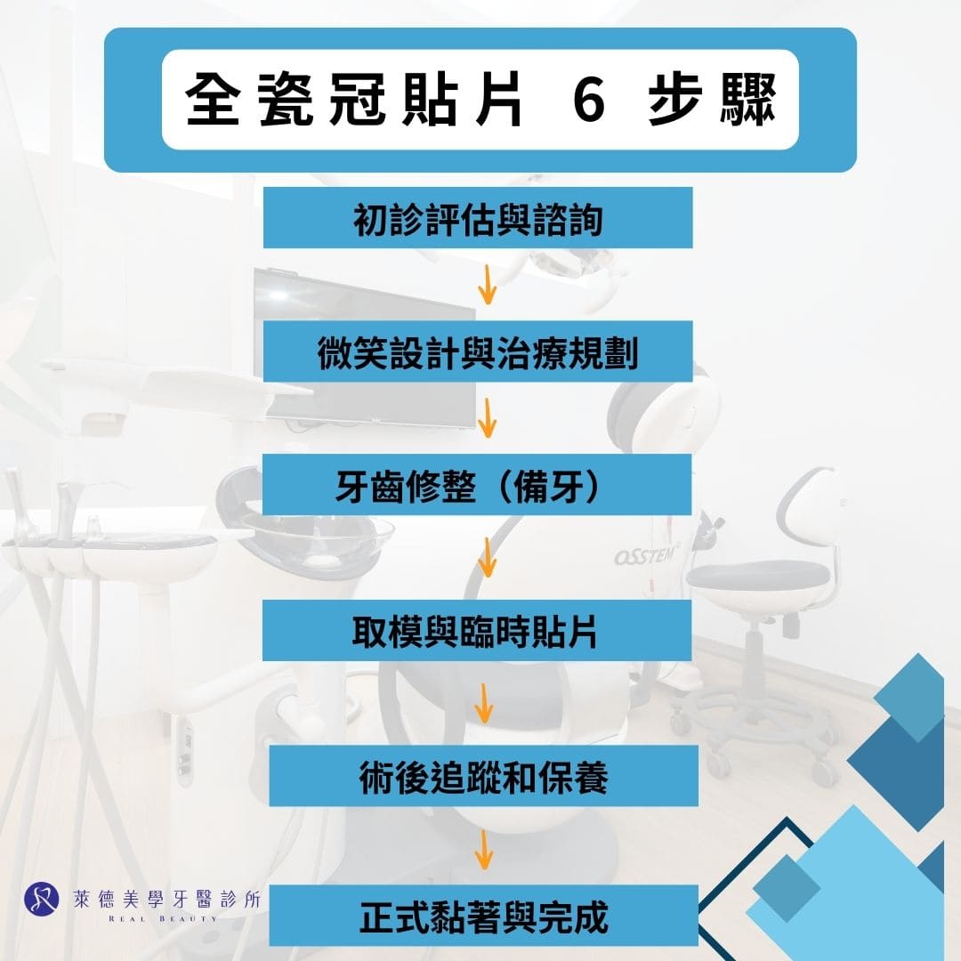 全瓷冠貼片適合誰?牙齒全瓷冠貼片價格、製作方式及保養全解析 3 全瓷冠貼片6步驟