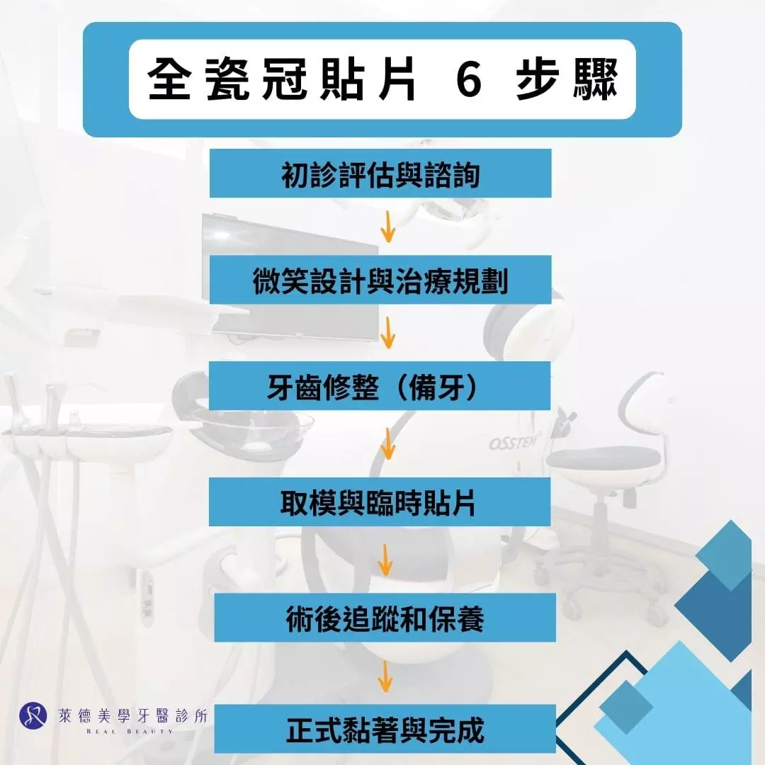 全瓷冠貼片6步驟