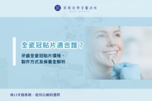 全瓷冠貼片適合誰？牙齒全瓷冠貼片價格、製作方式及保養全解析