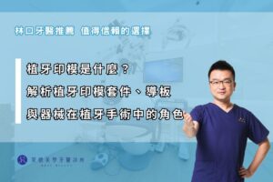 植牙印模是什麼？解析植牙印模套件、導板與器械在植牙手術中的角色