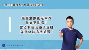 根管治療後吃東西會痛正常嗎？當心根管治療後臉腫與疼痛該這樣處理！