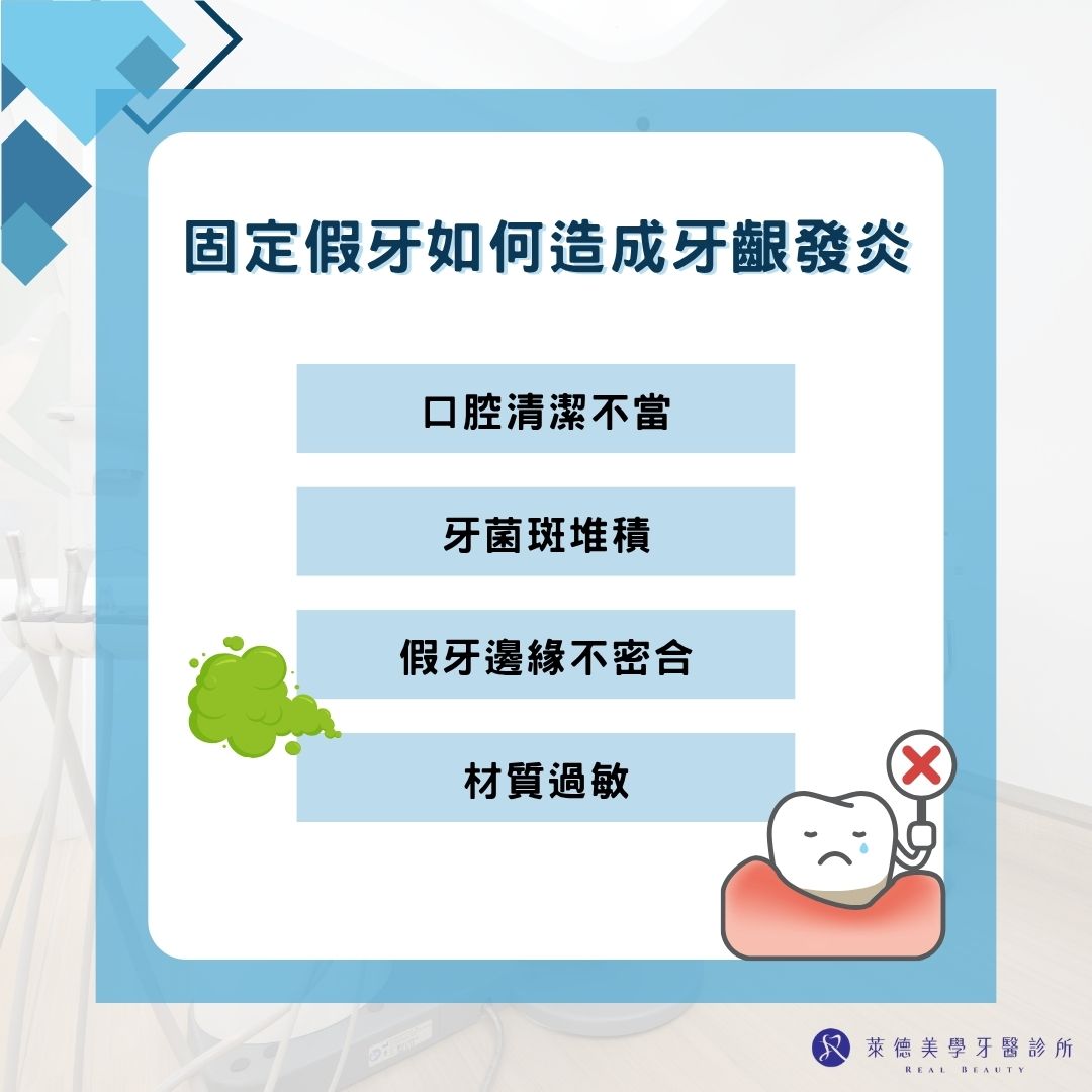 固定假牙如何造成牙齦發炎