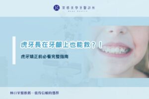虎牙長在牙齦上也能救？！虎牙矯正前必看完整指南