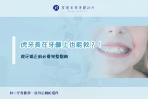 虎牙長在牙齦上也能救？！虎牙矯正前必看完整指南