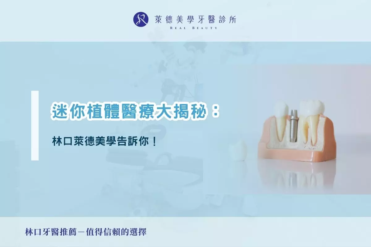 迷你植體醫療大揭秘：林口萊德美學告訴你！