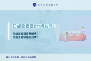 臼齒全瓷冠ptt網友問：臼齒全瓷冠容易斷嗎？臼齒全瓷冠適合我嗎？