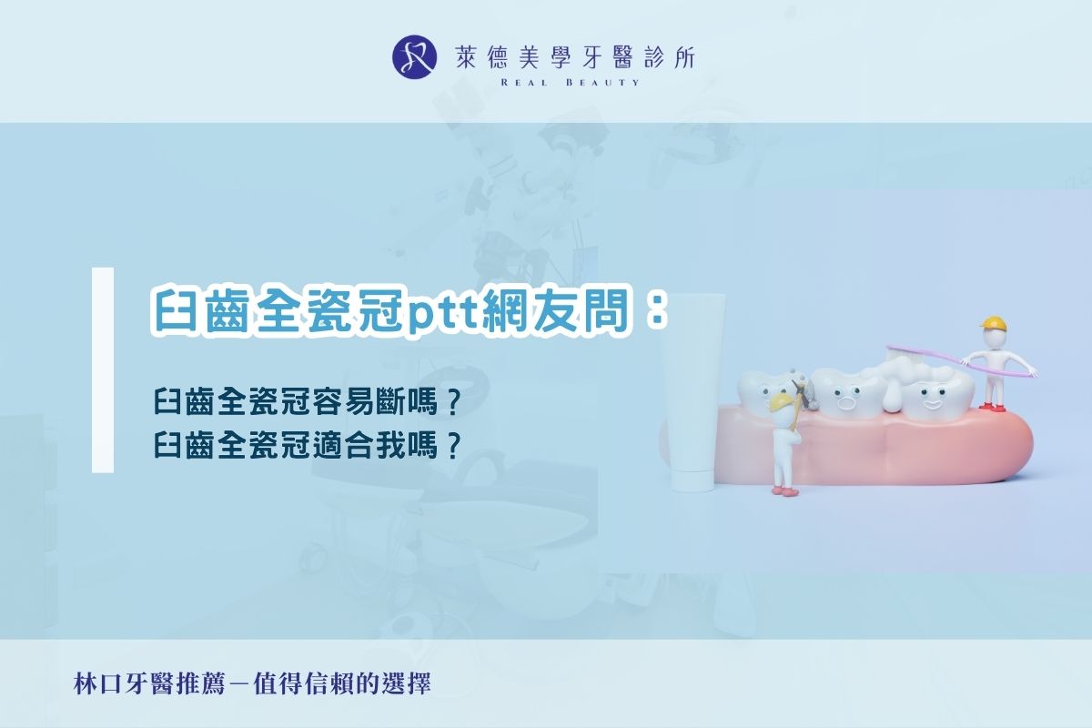 臼齒全瓷冠ptt網友問：臼齒全瓷冠容易斷嗎？臼齒全瓷冠適合我嗎？