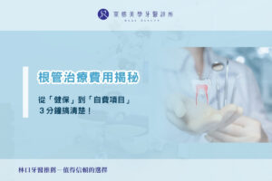 根管治療費用揭秘：從健保到自費項目三分鐘搞定