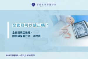 全瓷冠可以矯正嗎？全瓷冠矯正過程、限制級保養方式一次說明