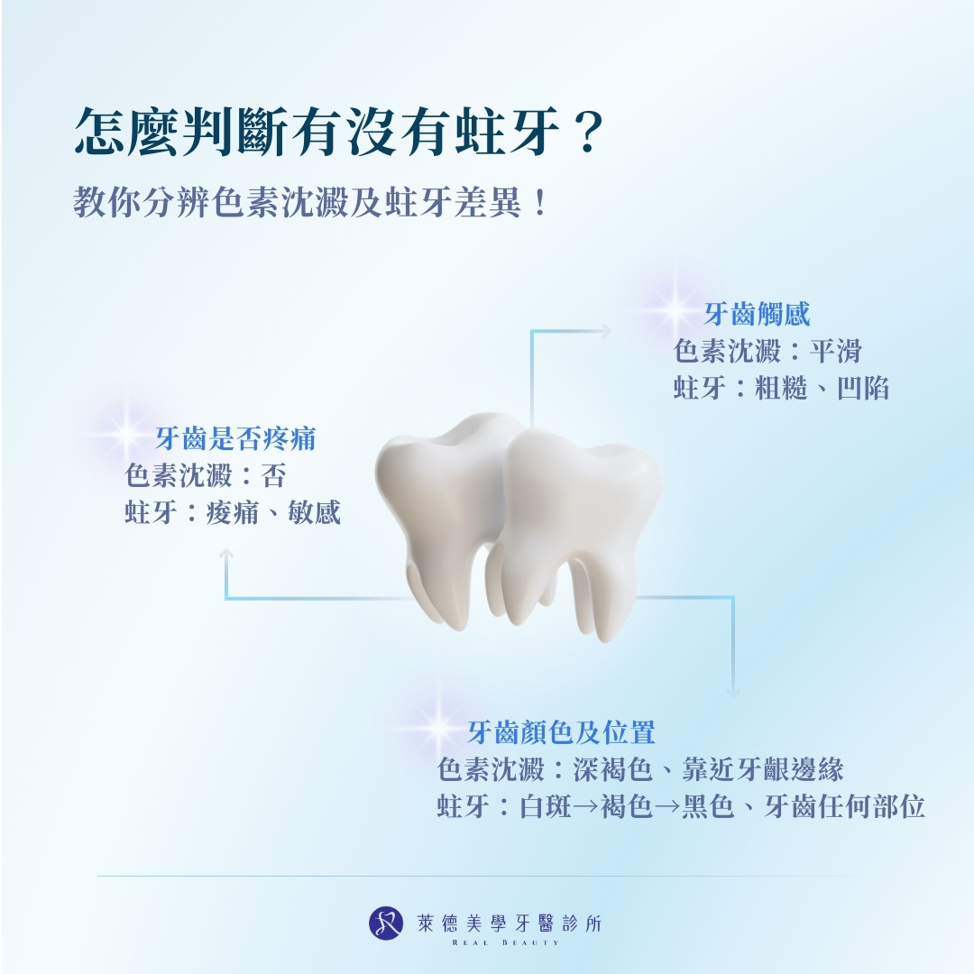 牙齒色素沉澱不等於蛀牙！教你分辨兩者差異