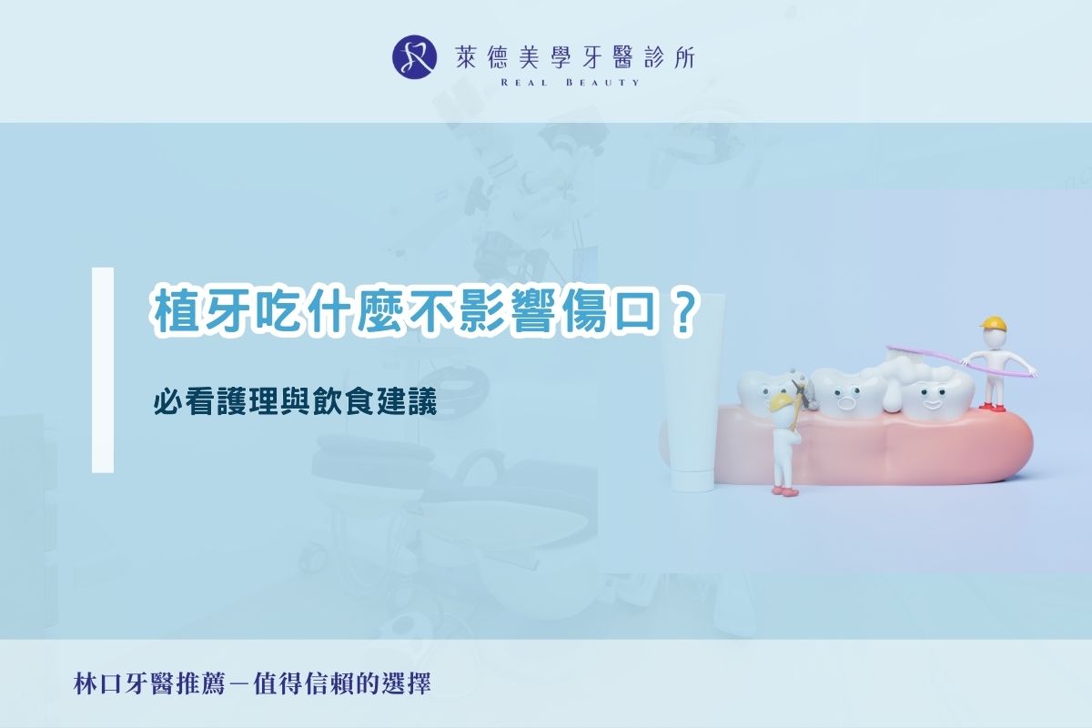 植牙吃什麼不影響傷口？必看護理與飲食建議