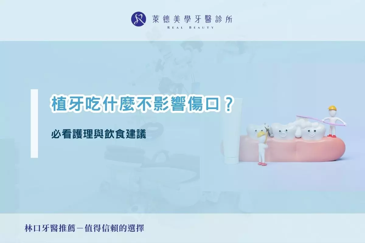 植牙吃什麼不影響傷口？必看護理與飲食建議