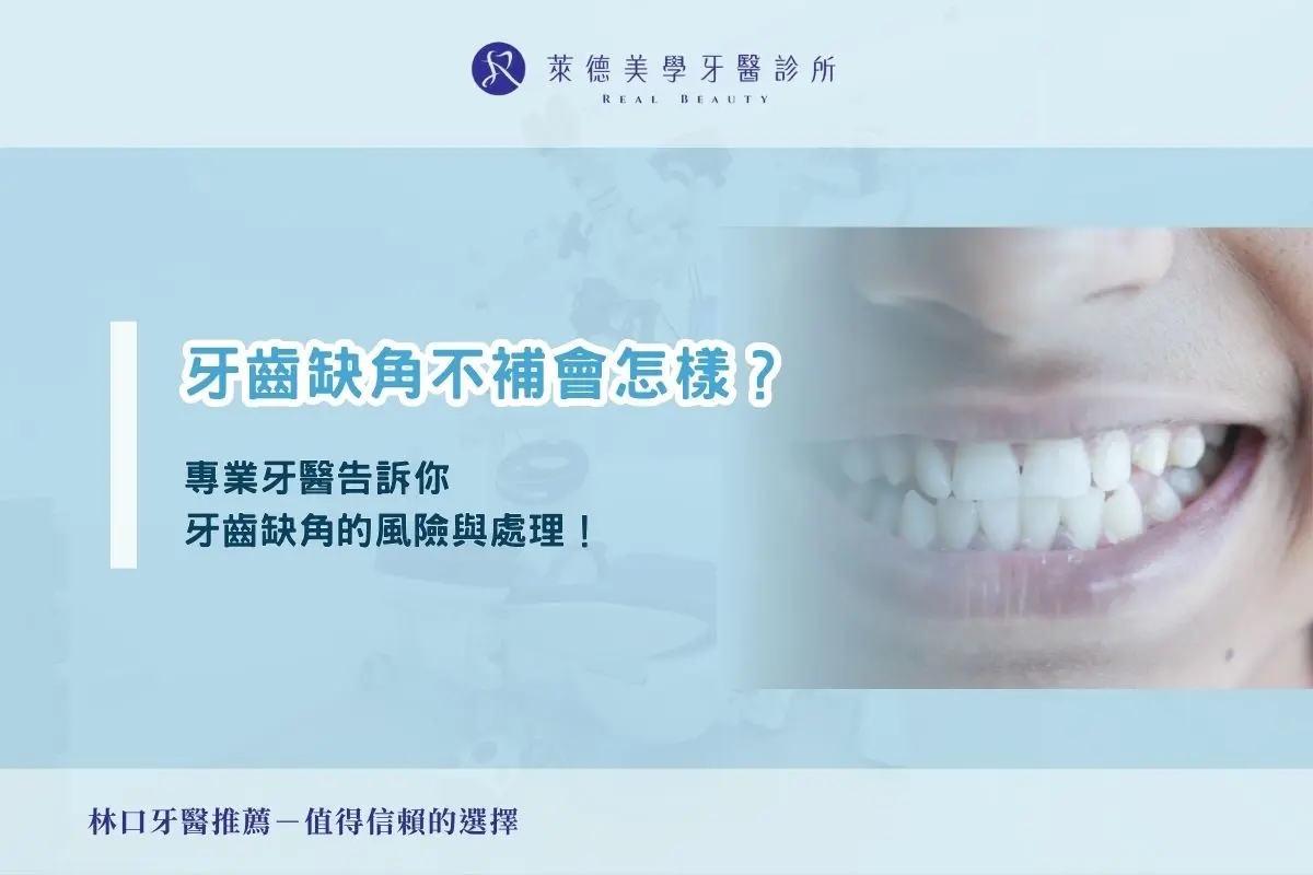 牙齒缺角不補會怎樣？專業牙醫告訴你缺角牙齒的風險與處理