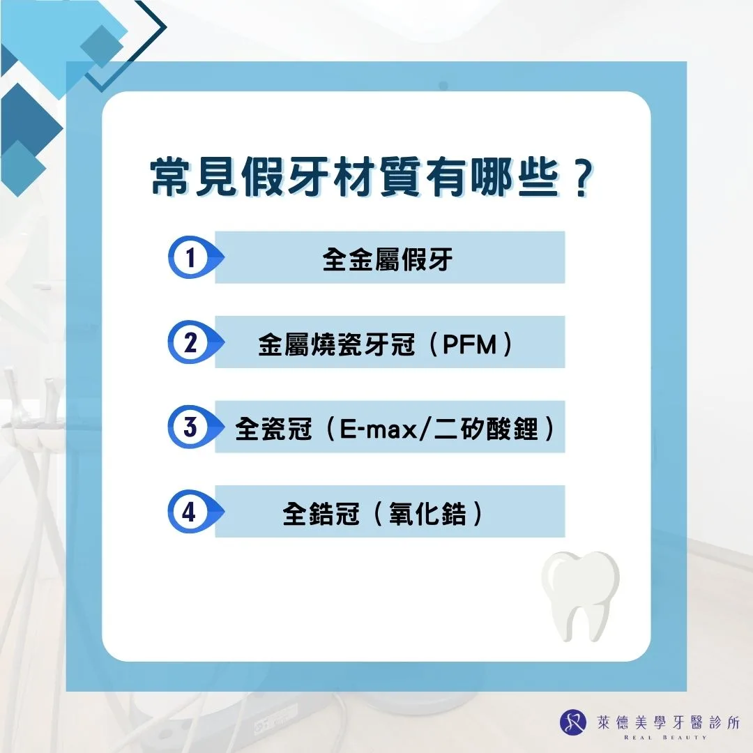 常見假牙材質有哪些？