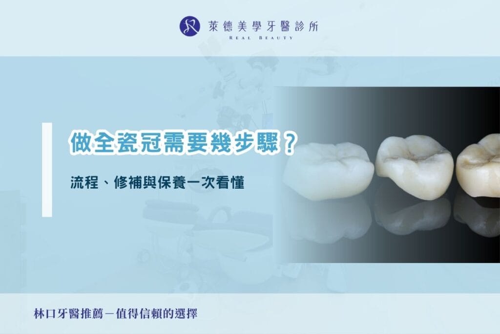 做全瓷冠需要幾步驟？流程、修補與保養一次看懂 | 萊德美學牙醫診所