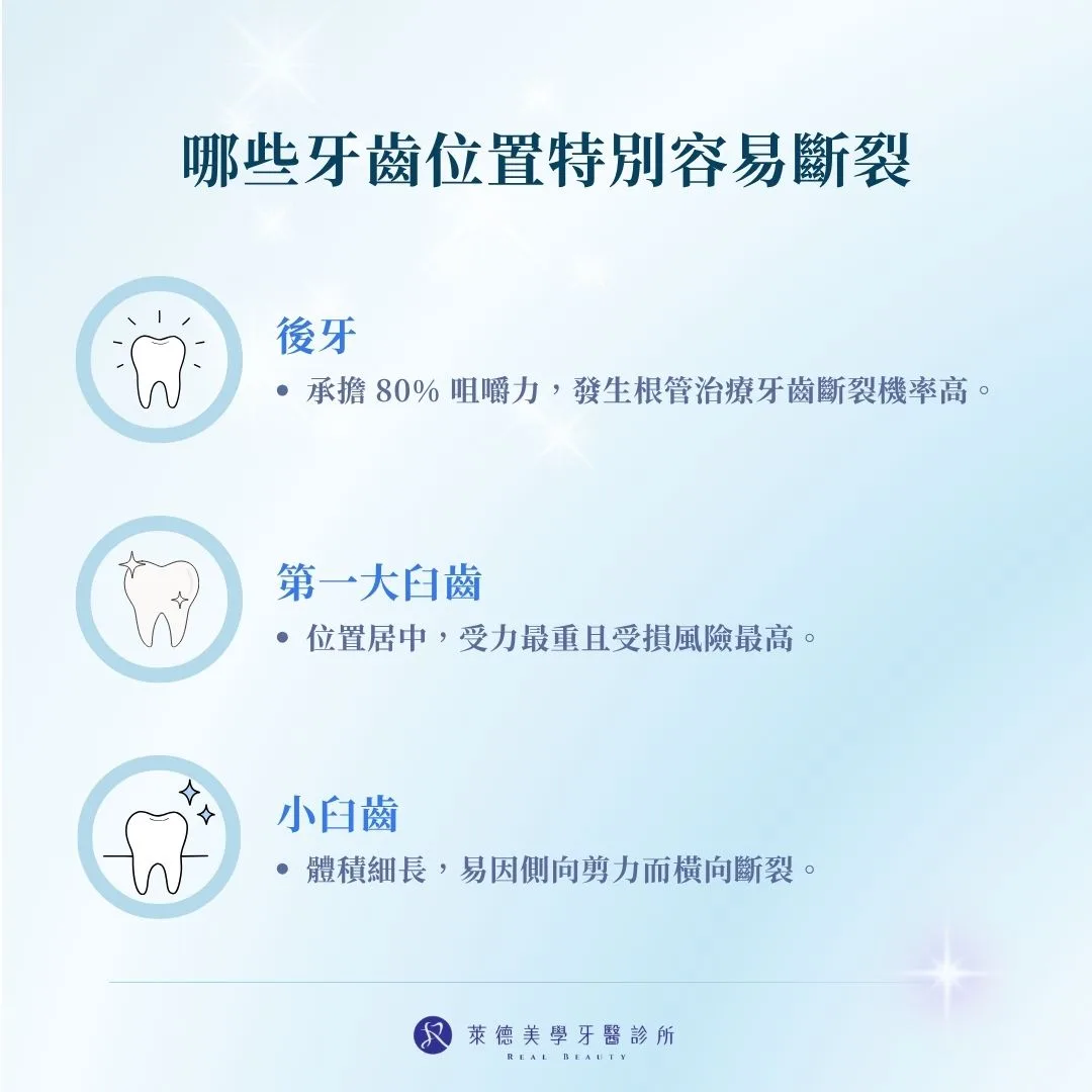 哪些牙齒位置特別容易斷裂