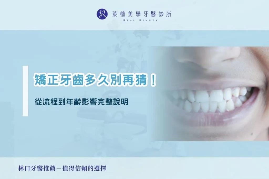 矯正牙齒多久別再猜！從流程到年齡影響完整說明