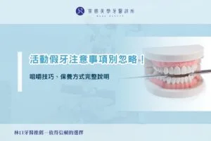 活動假牙注意事項別忽略!咀嚼技巧、保養方式完整說明