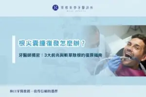 根尖囊腫復發怎麼辦？牙醫師揭密：3 大前兆與斬草除根的復原指南