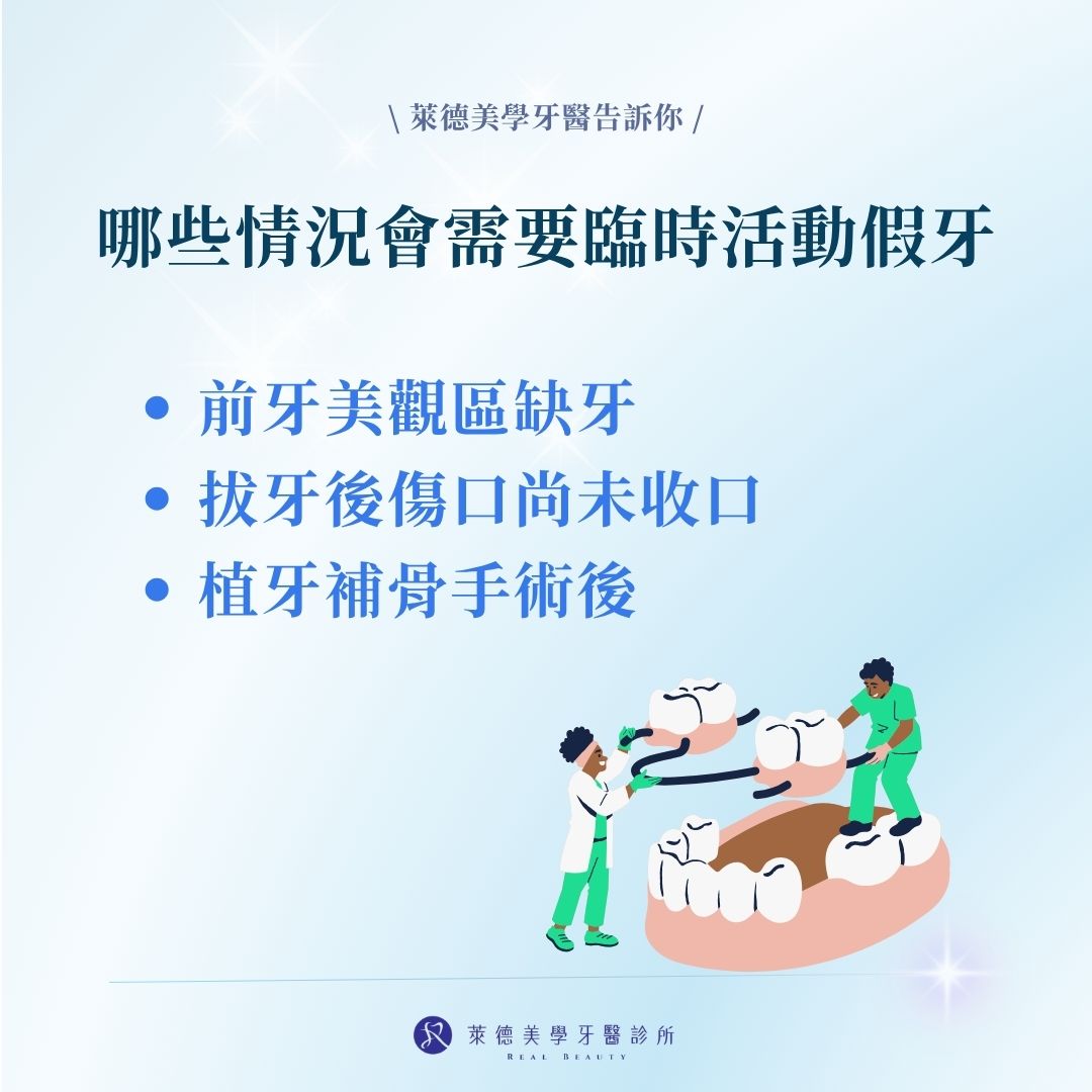 哪些情況會需要臨時活動假牙