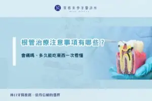 根管治療注意事項有哪些？會痛嗎、多久能吃東西一次看懂