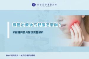 根管治療後不舒服怎麼辦?牙齦腫與發炎警訊完整解析