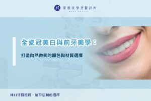 全瓷冠美白與前牙美學:打造自然微笑的顏色與材質選擇