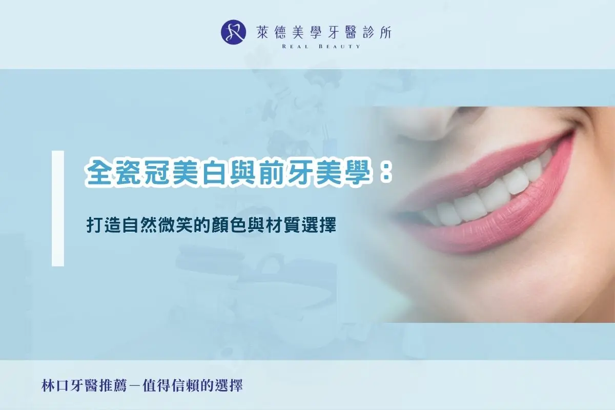 全瓷冠美白與前牙美學：打造自然微笑的顏色與材質選擇
