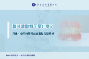 臨時活動假牙是什麼？用途、使用時間與飲食重點完整解析