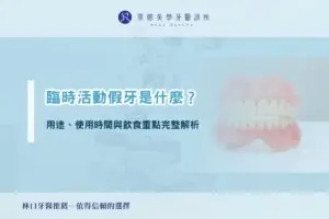 臨時活動假牙是什麼？用途、使用時間與飲食重點完整解析