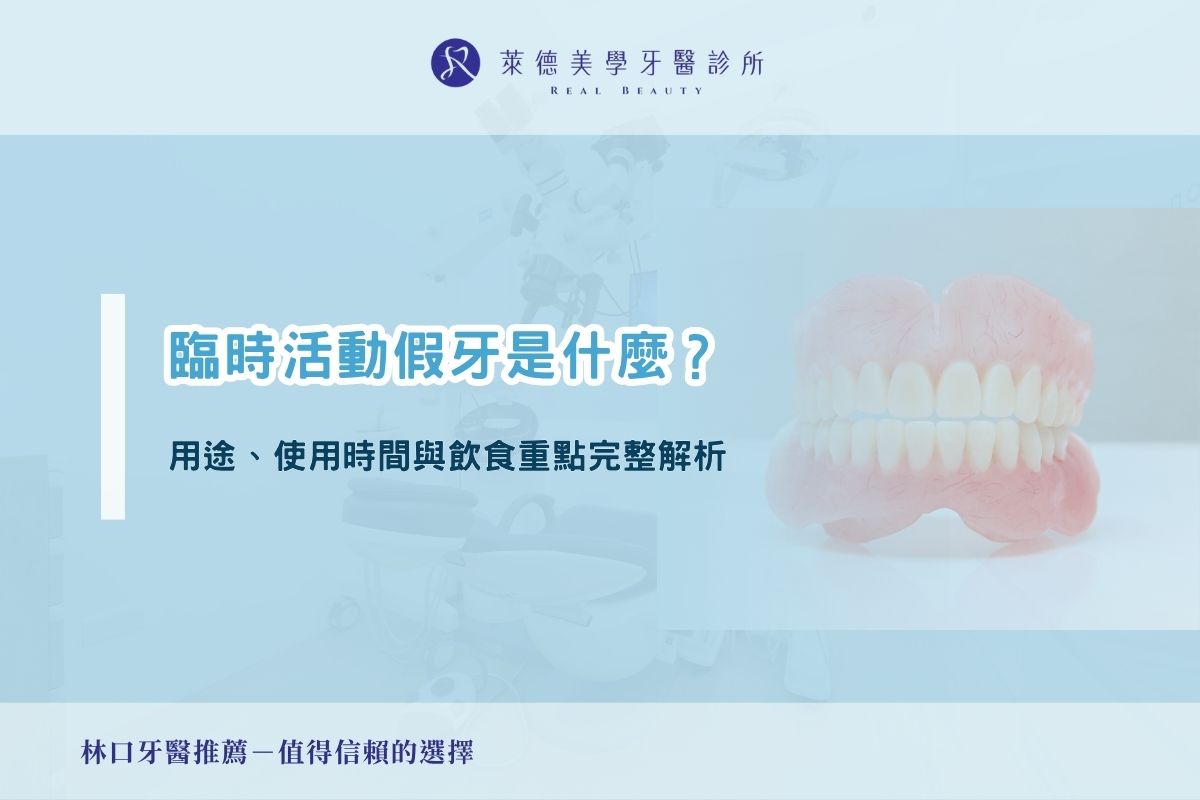 臨時活動假牙是什麼？用途、使用時間與飲食重點完整解析