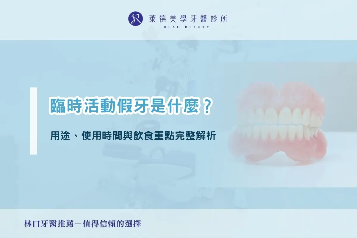 臨時活動假牙是什麼？用途、使用時間與飲食重點完整解析