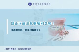 矯正牙齒注意事項別忽略！牙齒會痛嗎、副作用有哪些？